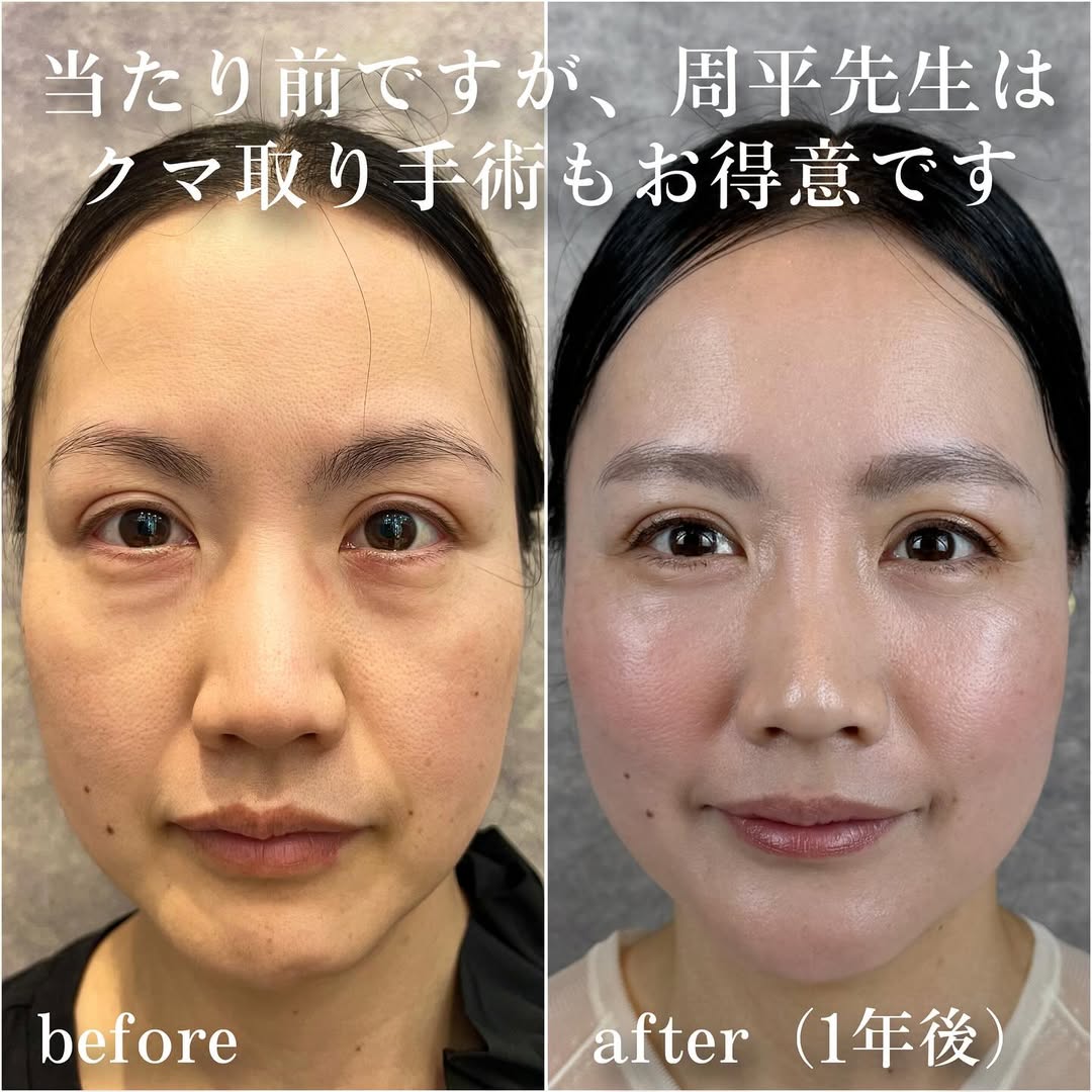 No.13315の症例写真