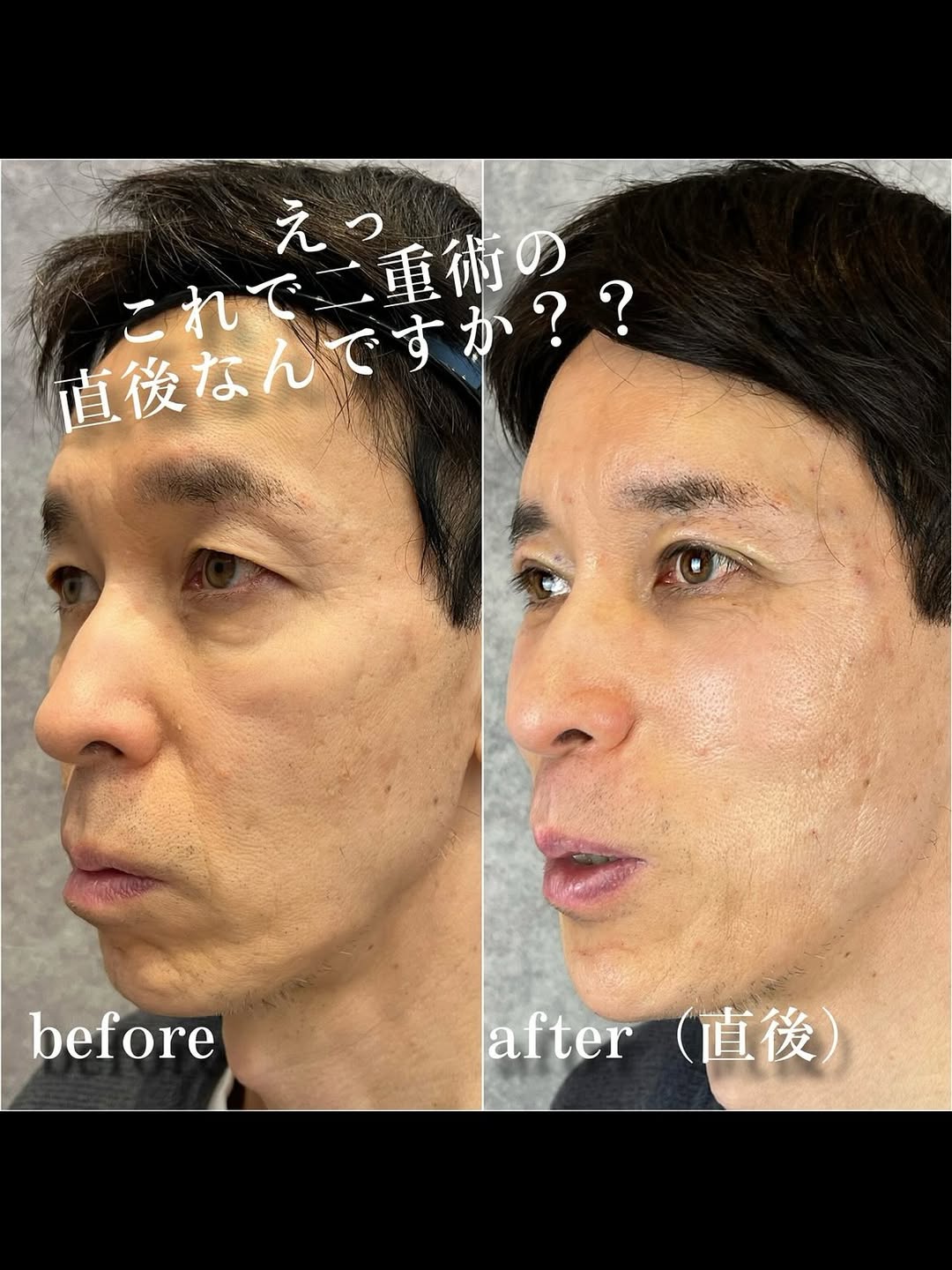 No.13335の症例写真 No.13335の症例写真