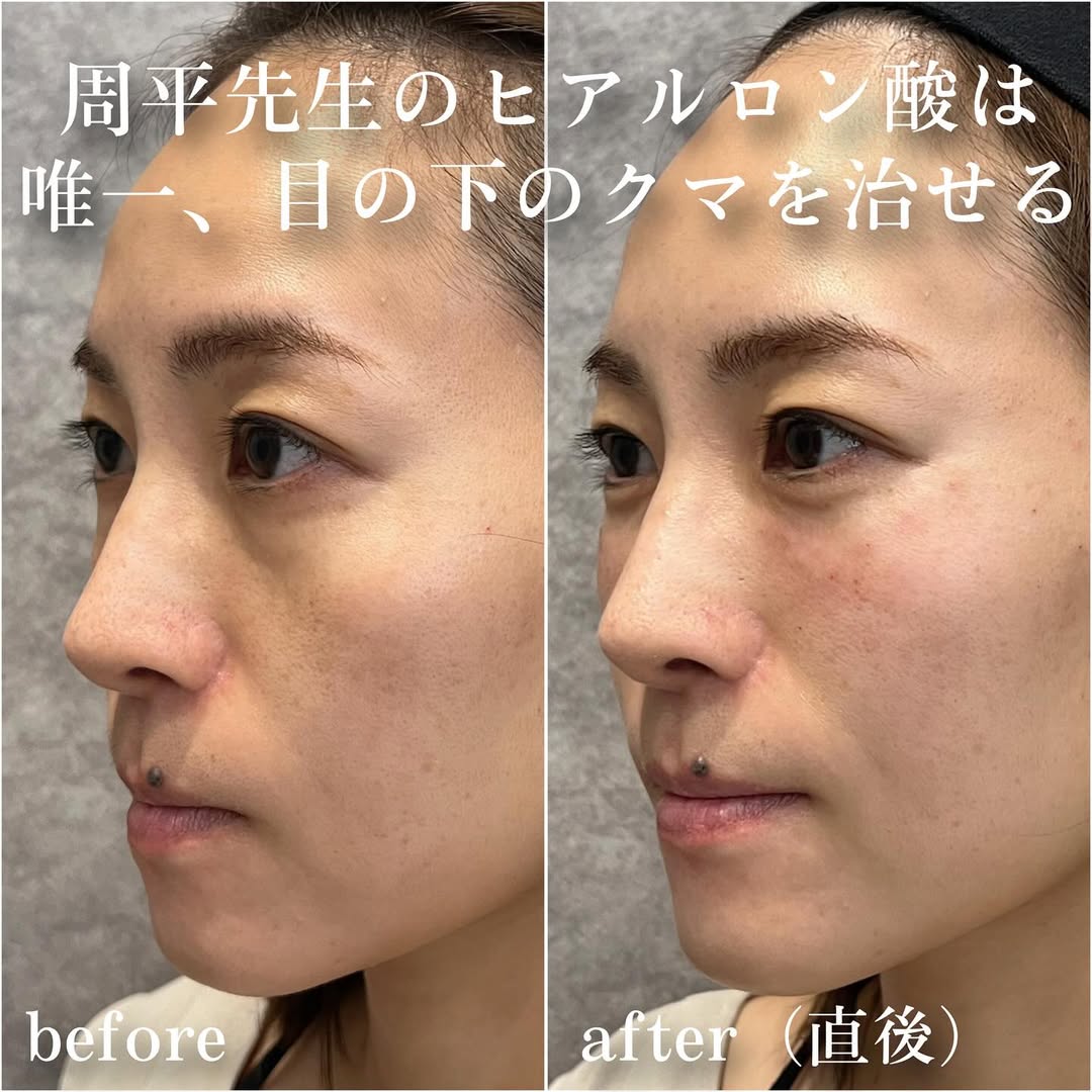 No.13395の症例写真 No.13395の症例写真