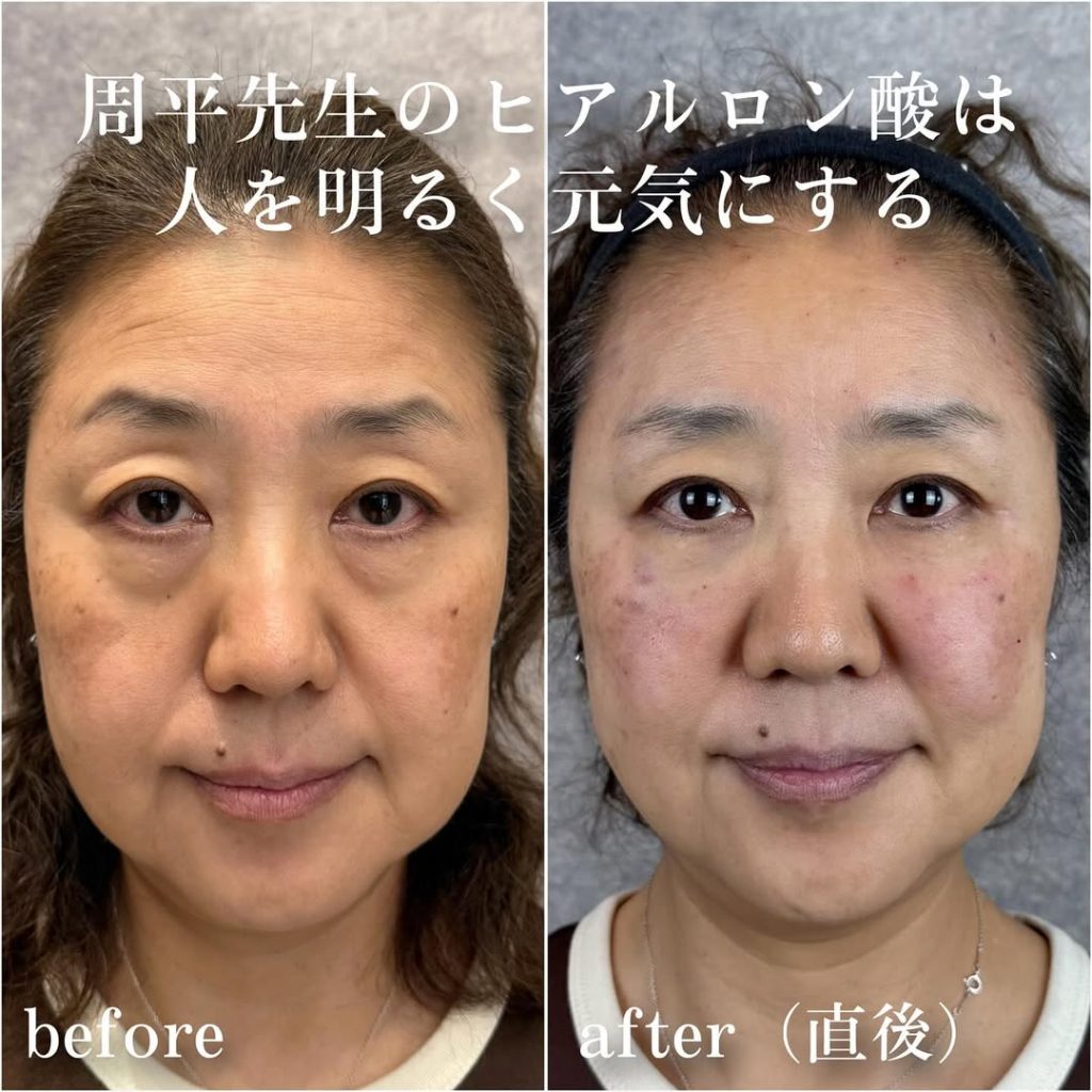 ビフォーアフター