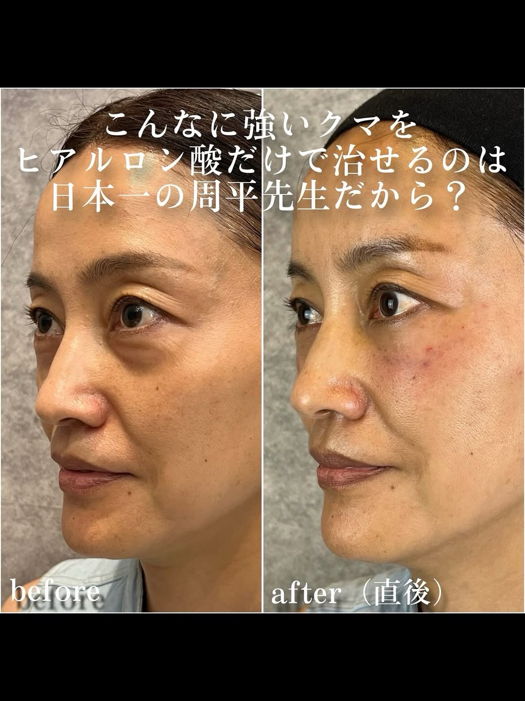 No.13504の症例写真 No.13504の症例写真