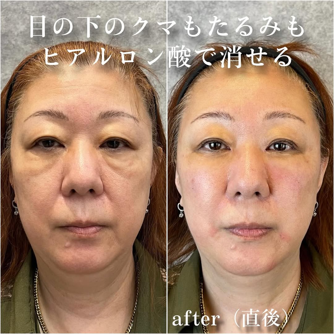 No.13413の症例写真 No.13413の症例写真