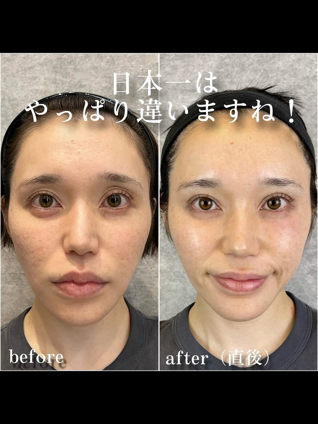 No.13371の症例写真 No.13371の症例写真