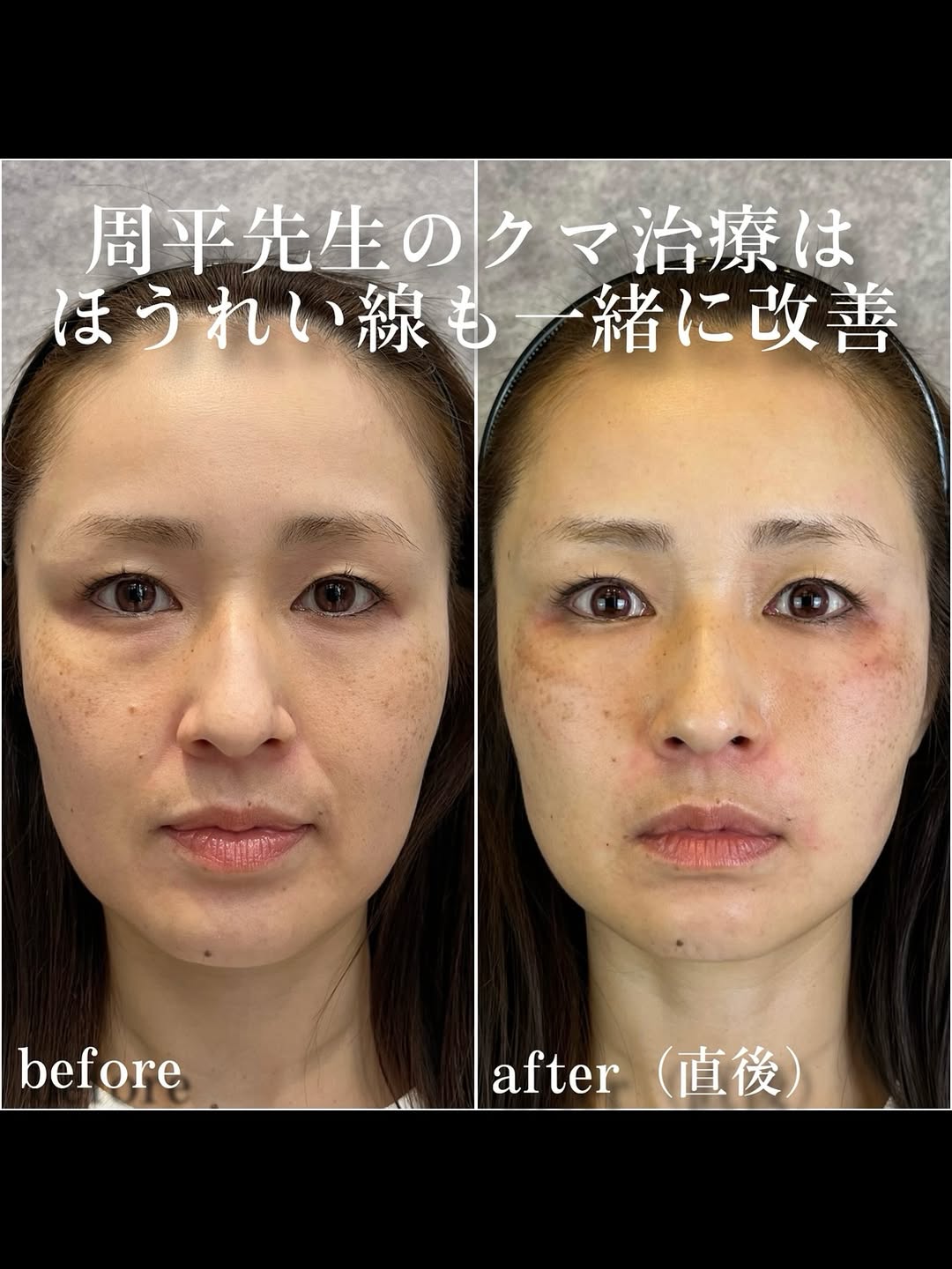 No.13379の症例写真 No.13379の症例写真