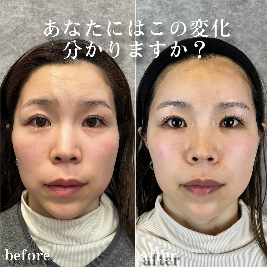 No.13478の症例写真 No.13478の症例写真
