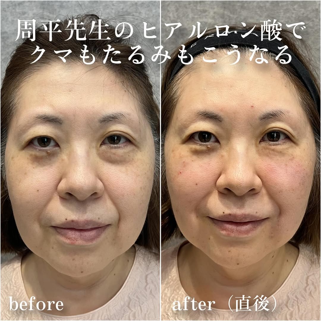 No.13390の症例写真 No.13390の症例写真