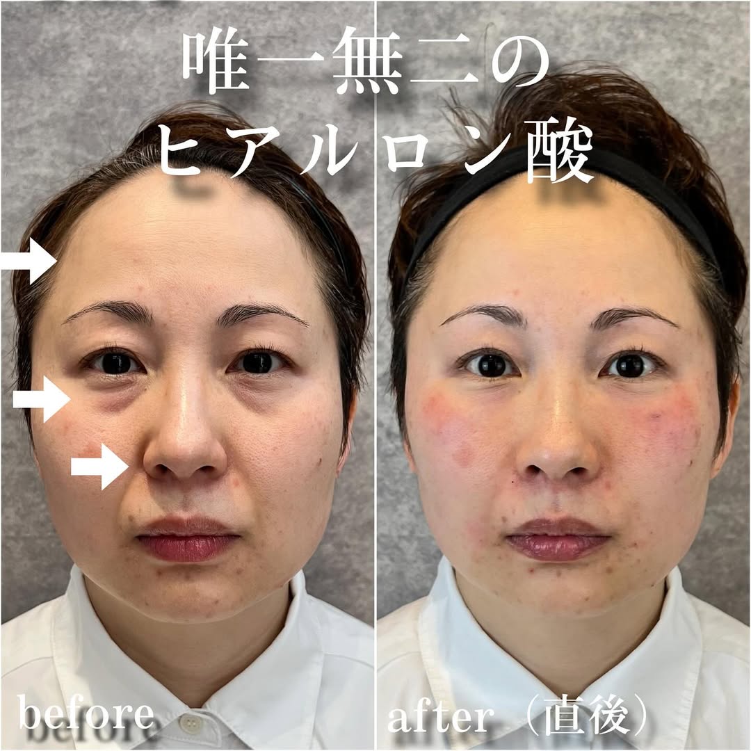 No.13431の症例写真 No.13431の症例写真
