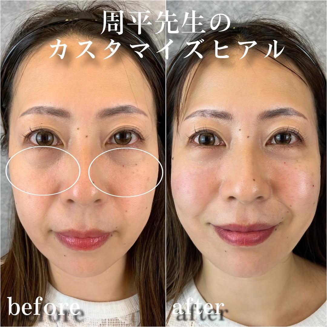 No.13470の症例写真 No.13470の症例写真