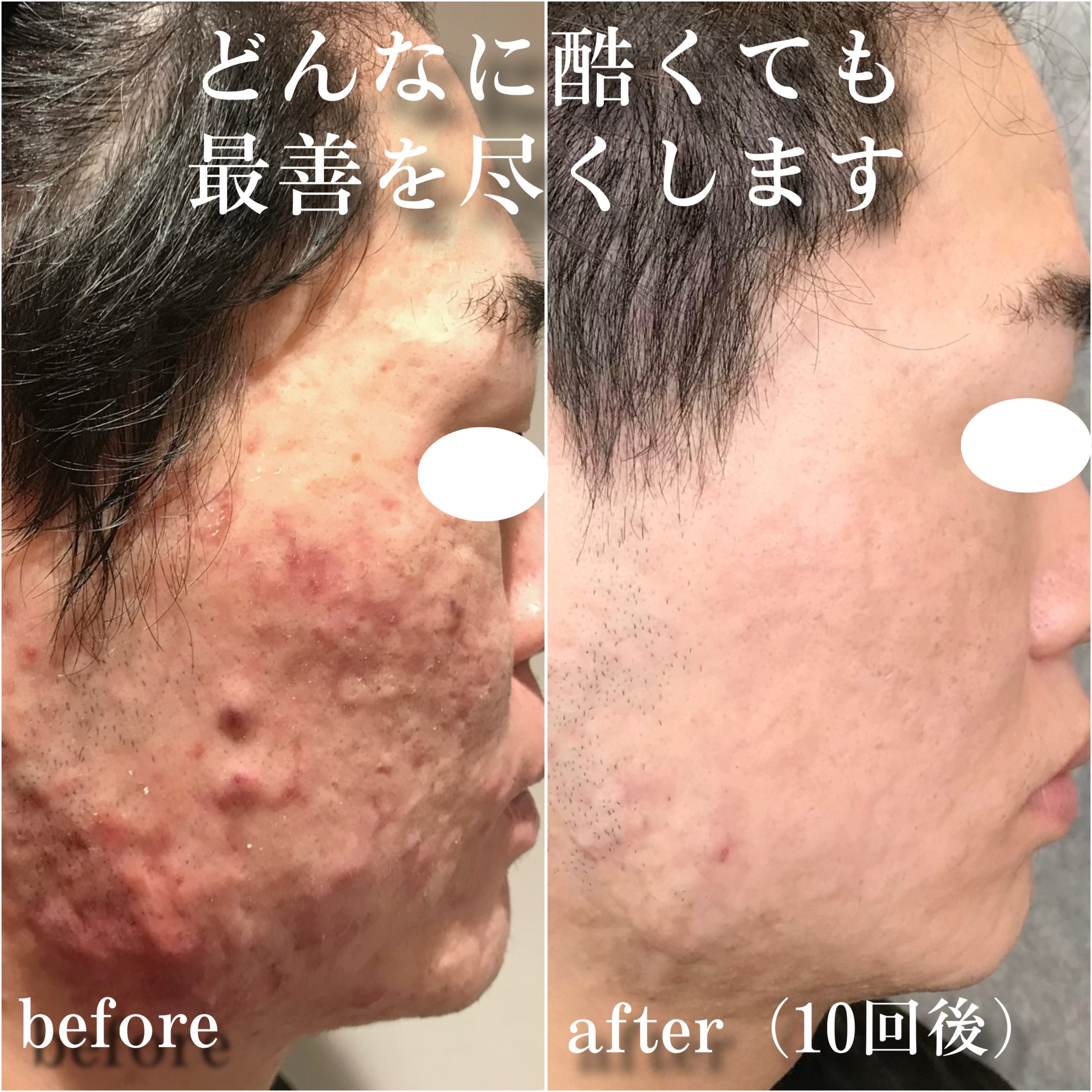 No.13279の症例写真