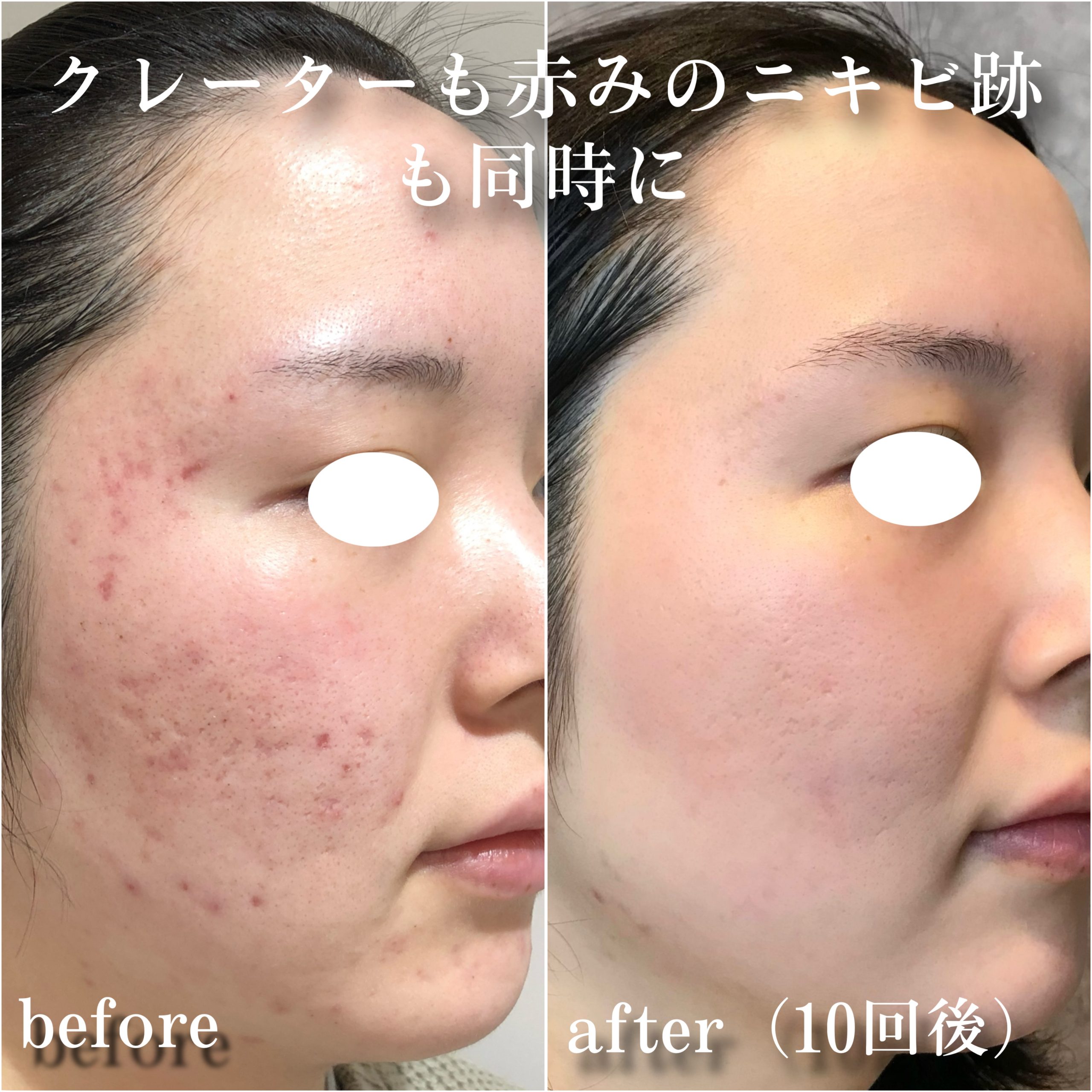 No.13285の症例写真