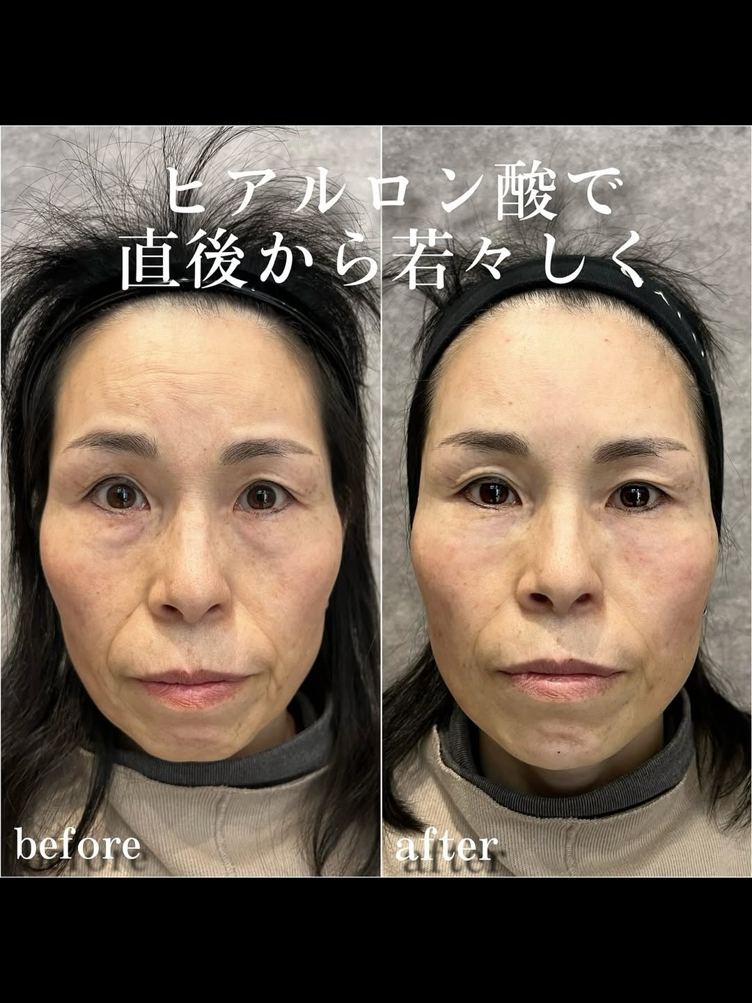 No.13500の症例写真 No.13500の症例写真