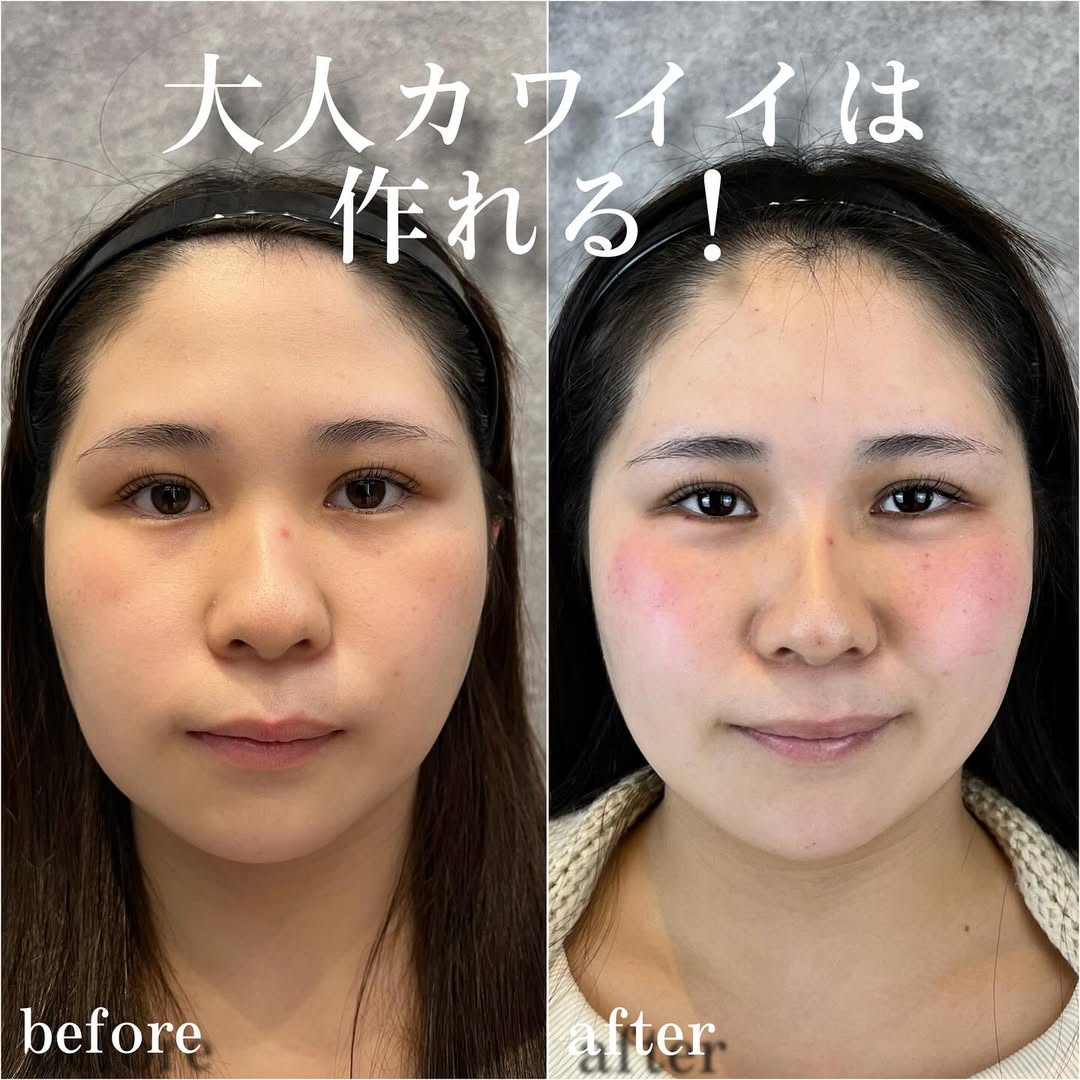 No.13496の症例写真