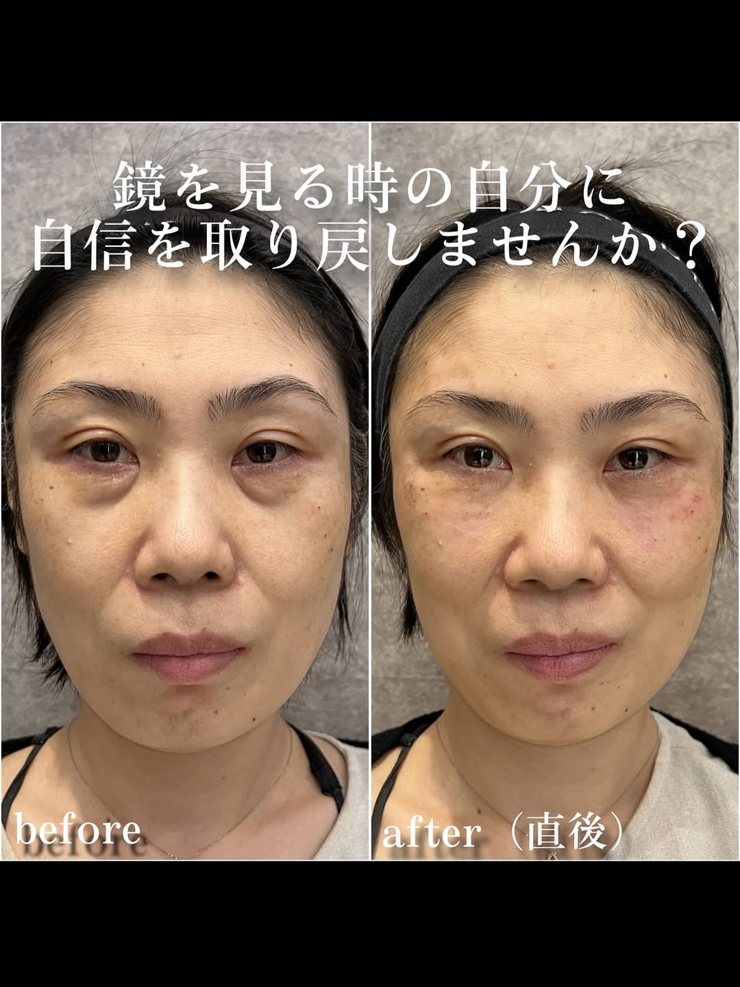 No.13360の症例写真