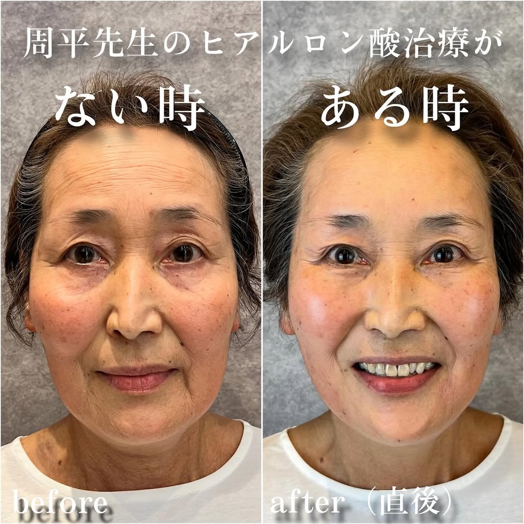No.13356の症例写真 No.13356の症例写真