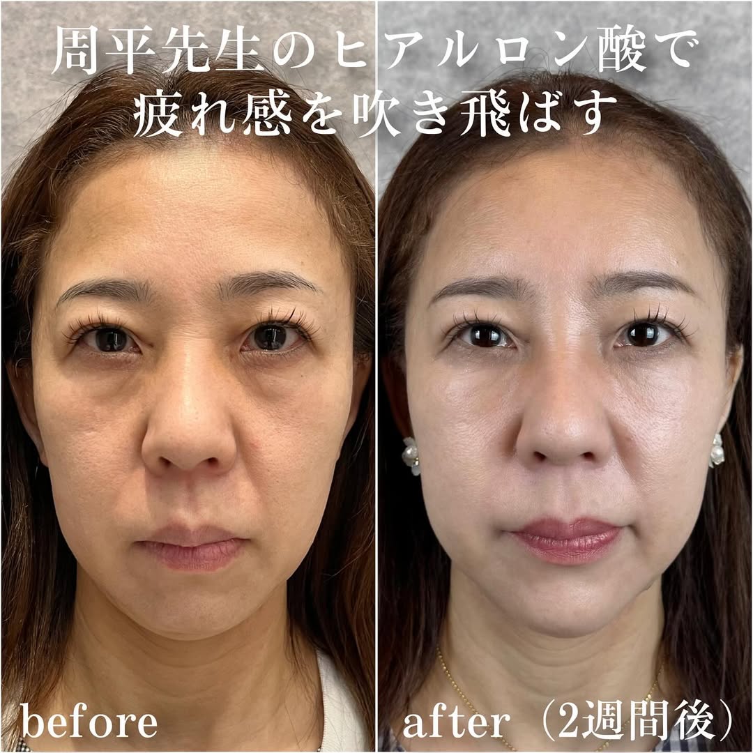 No.13484の症例写真 No.13484の症例写真