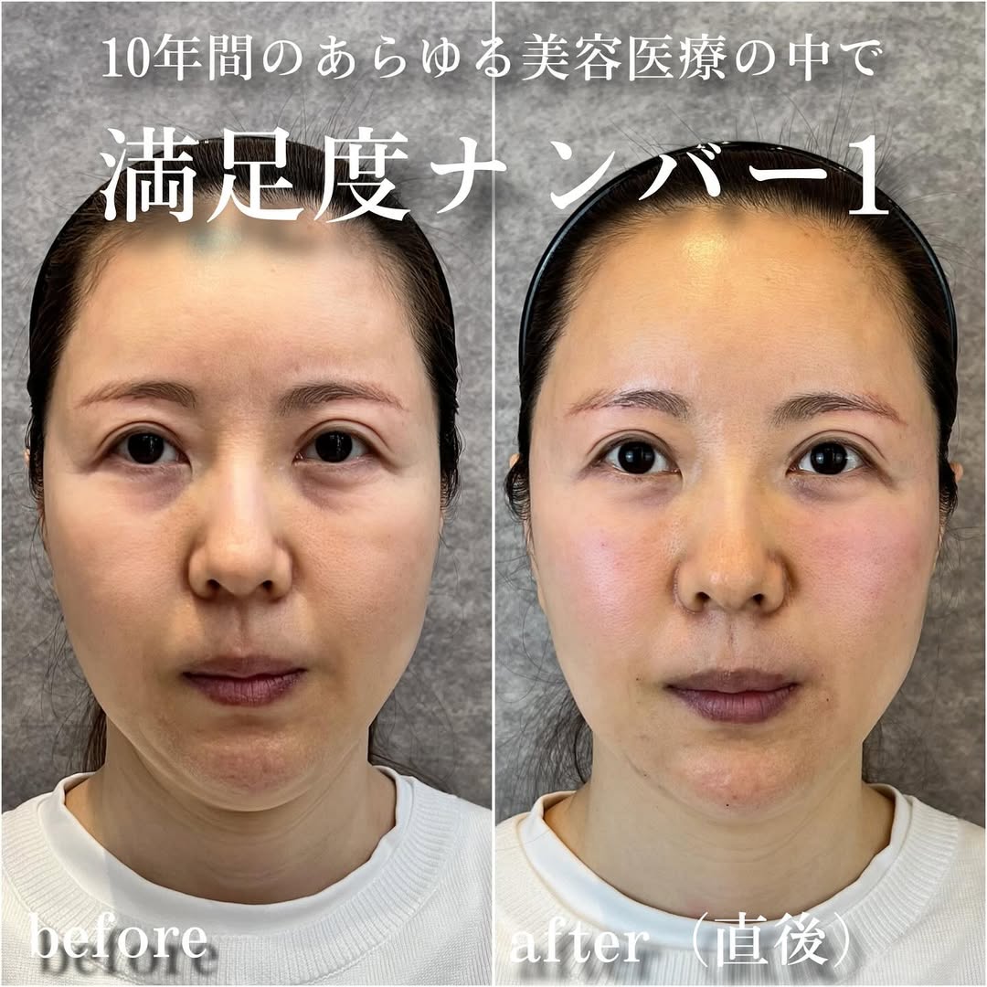 No.13344の症例写真 No.13344の症例写真
