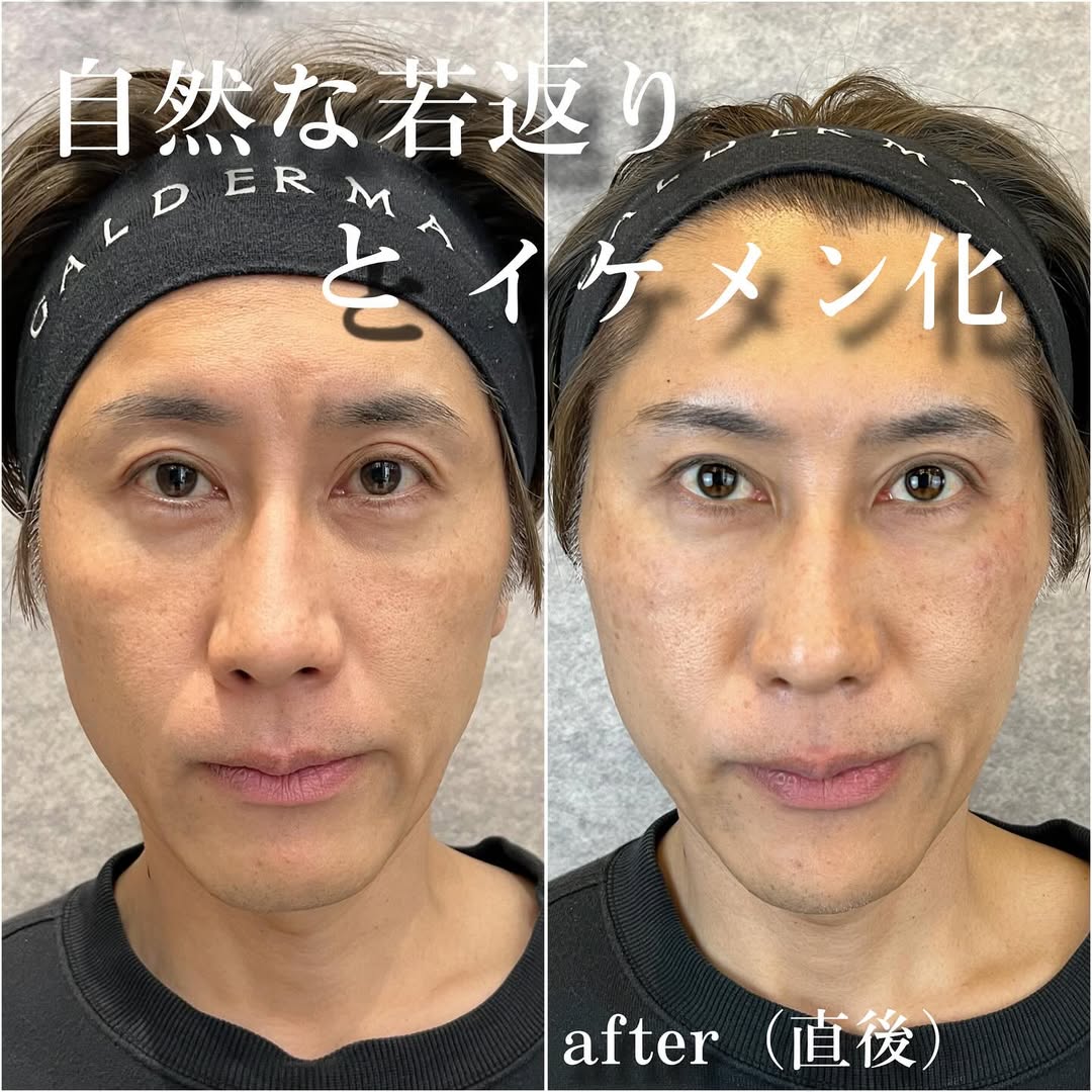 No.13461の症例写真 No.13461の症例写真