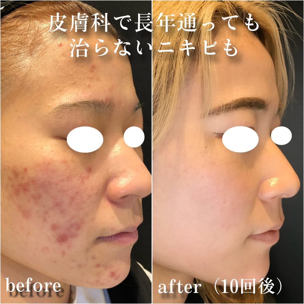 ビフォーアフター