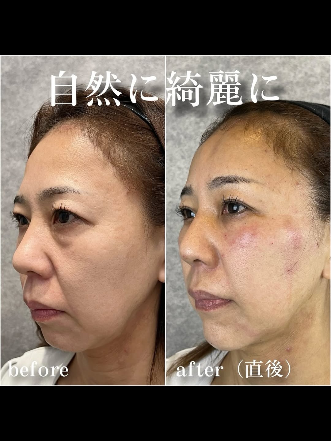 No.13349の症例写真 No.13349の症例写真