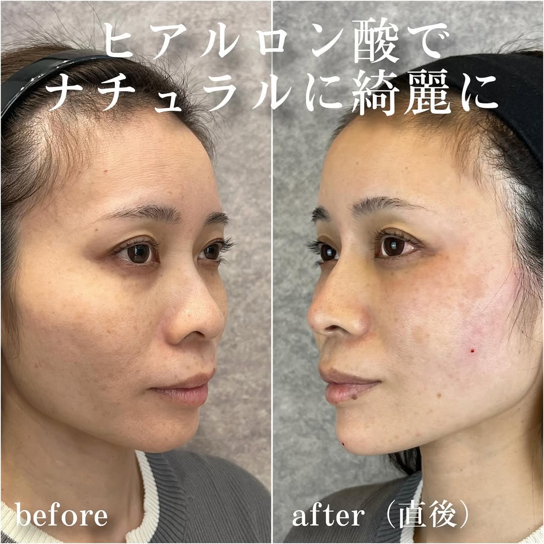 No.13404の症例写真 No.13404の症例写真
