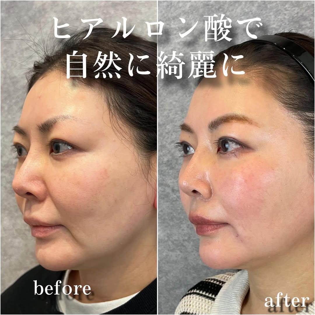 No.13465の症例写真