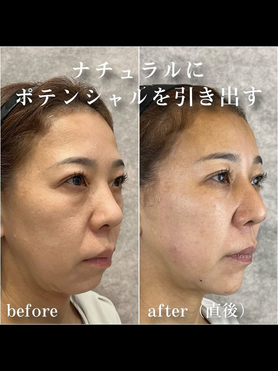 No.13508の症例写真 No.13508の症例写真