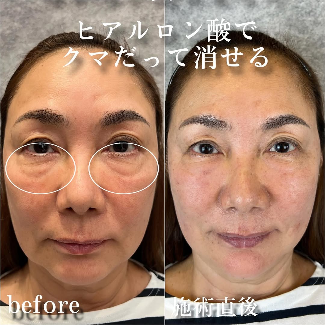 No.13339の症例写真 No.13339の症例写真