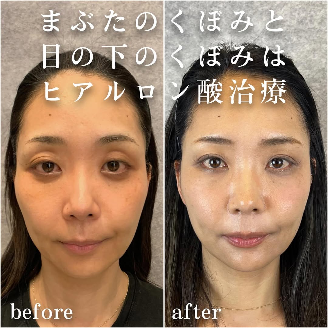 No.13408の症例写真 No.13408の症例写真