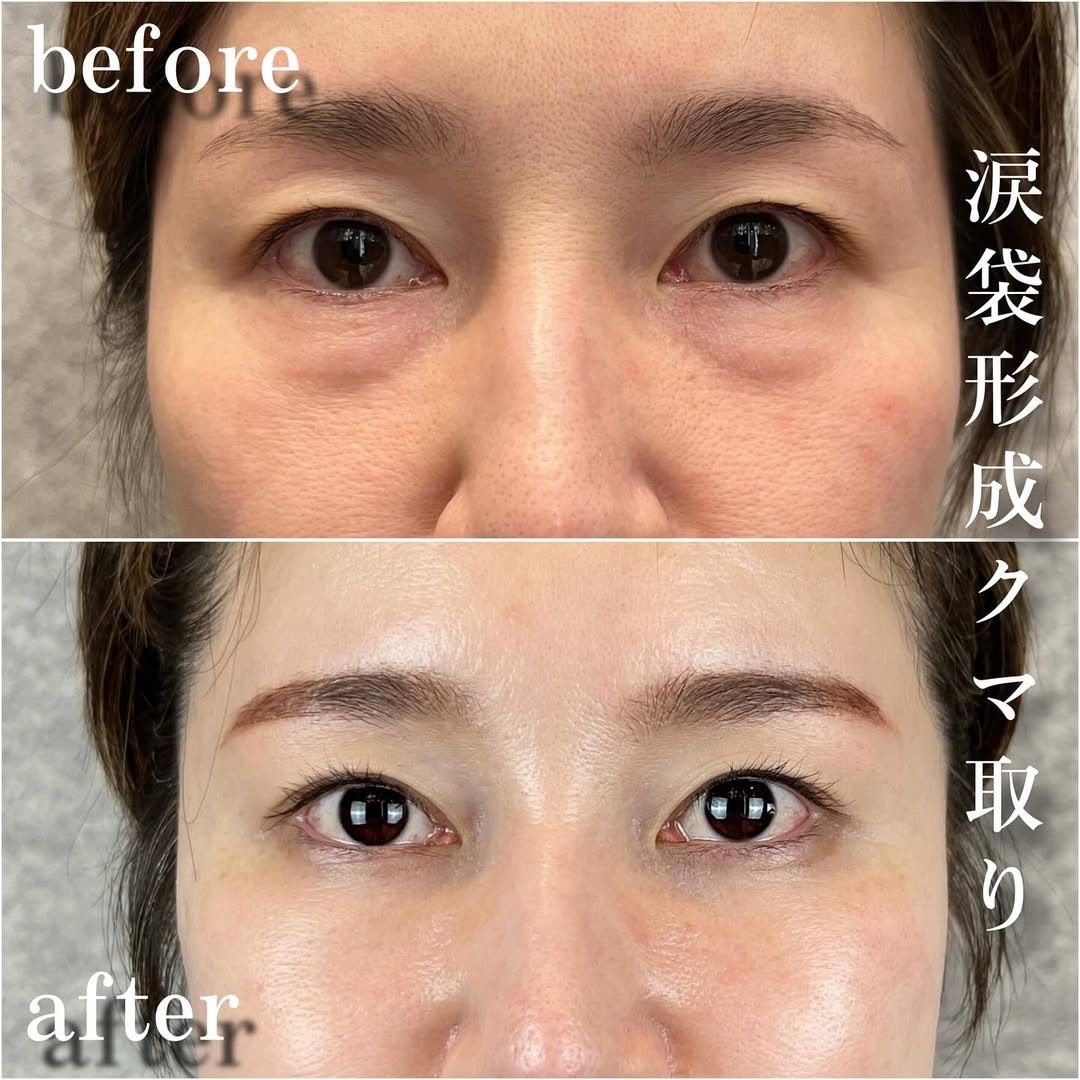 No.13522の症例写真