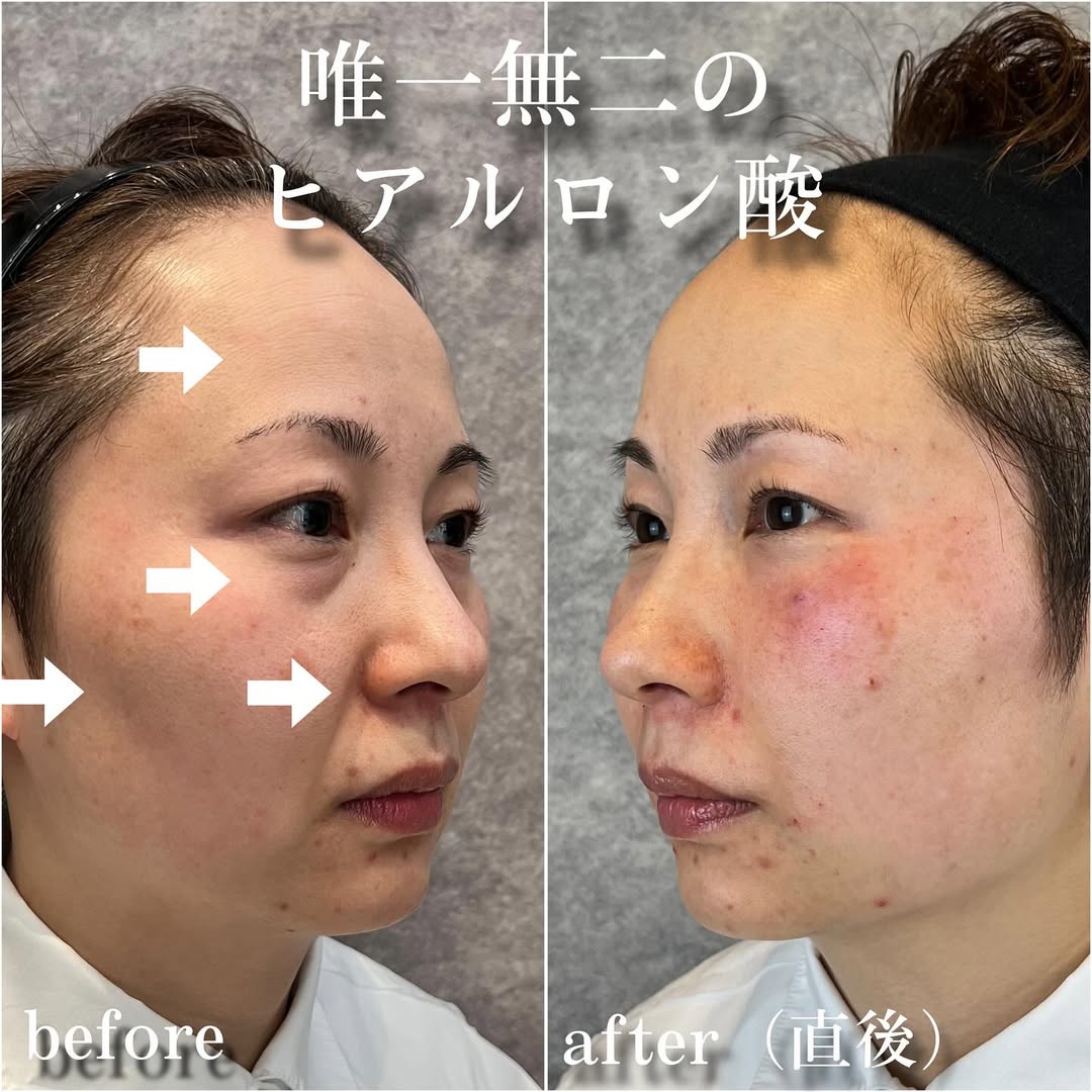 No.13528の症例写真