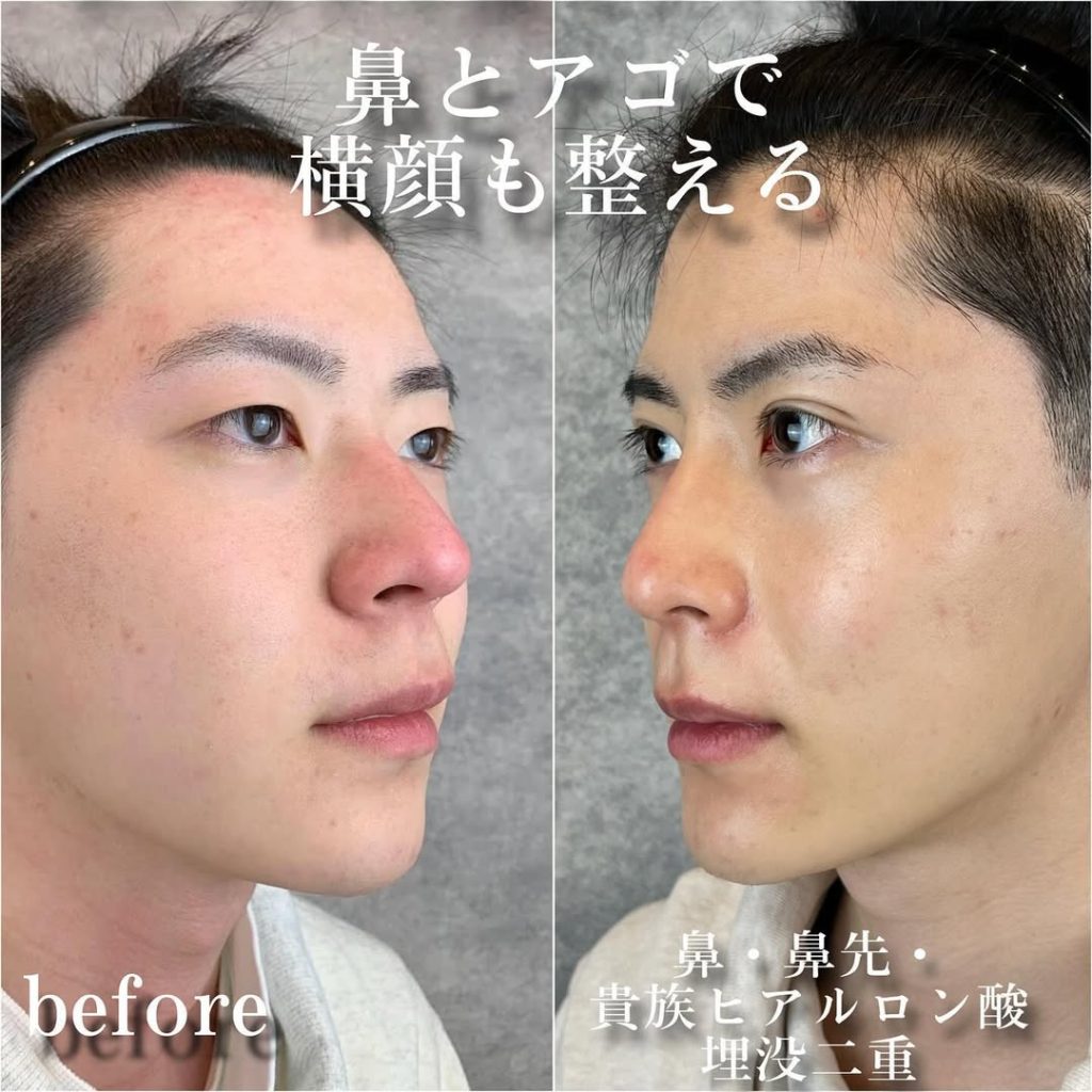 ビフォーアフター