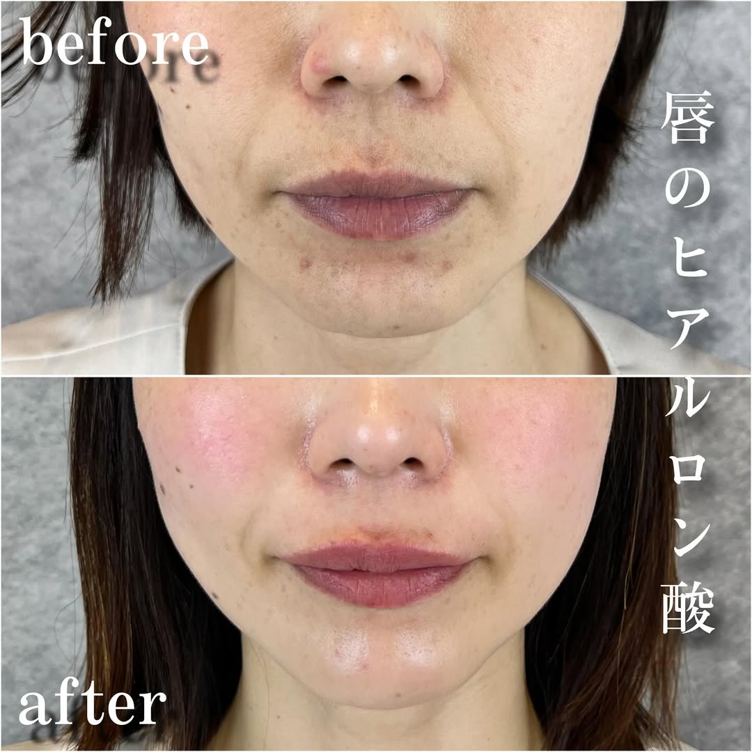 No.13517の症例写真