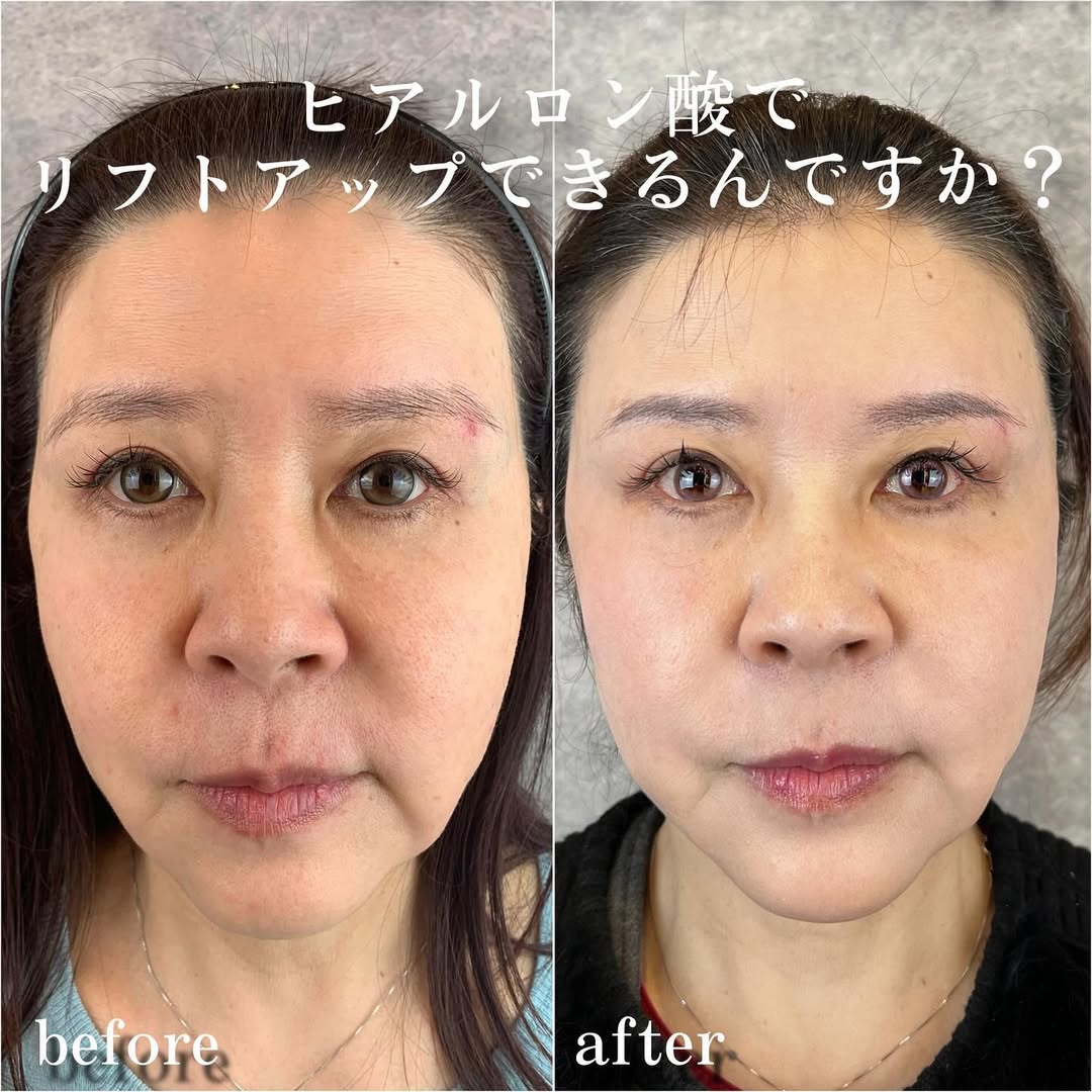 No.13549の症例写真