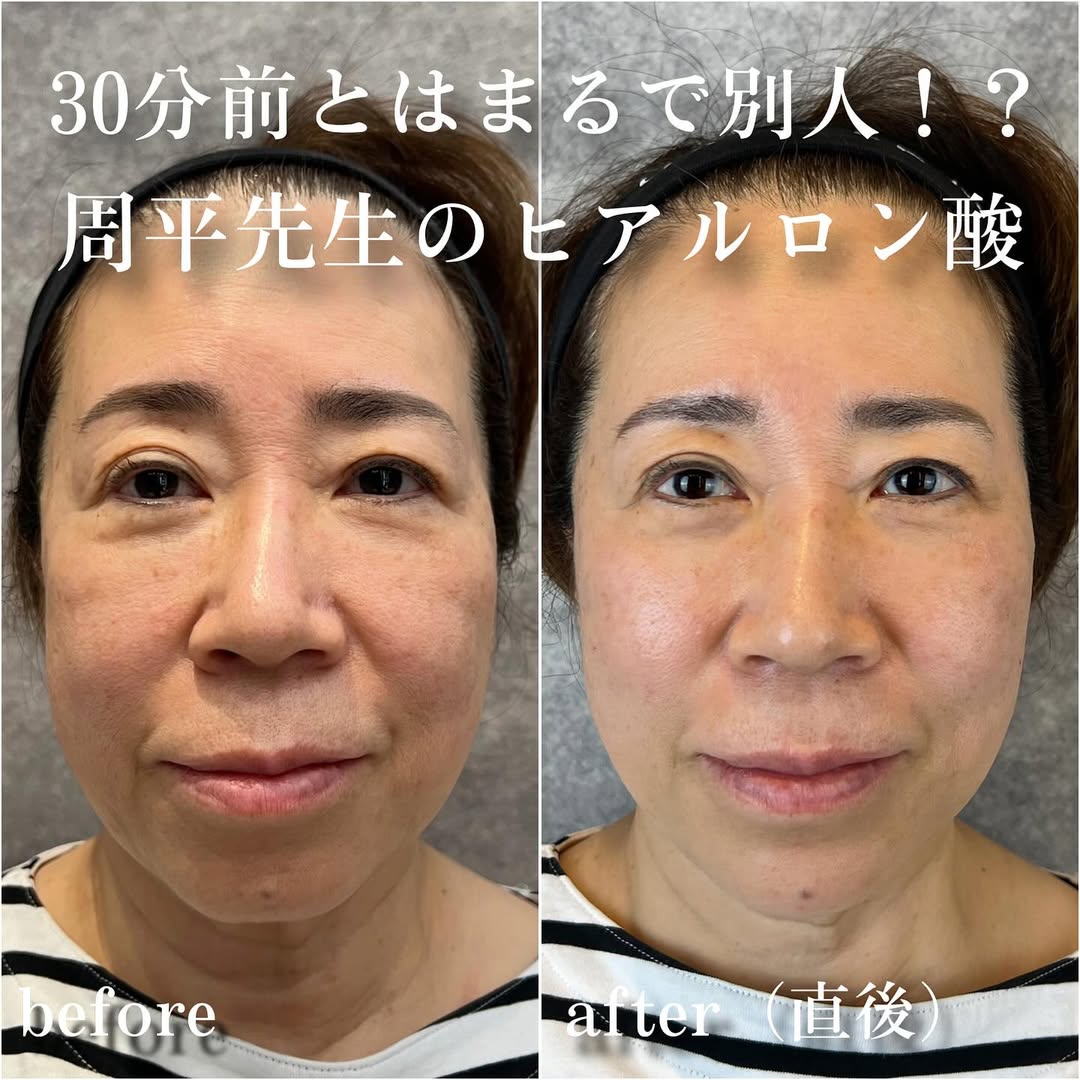 No.13540の症例写真