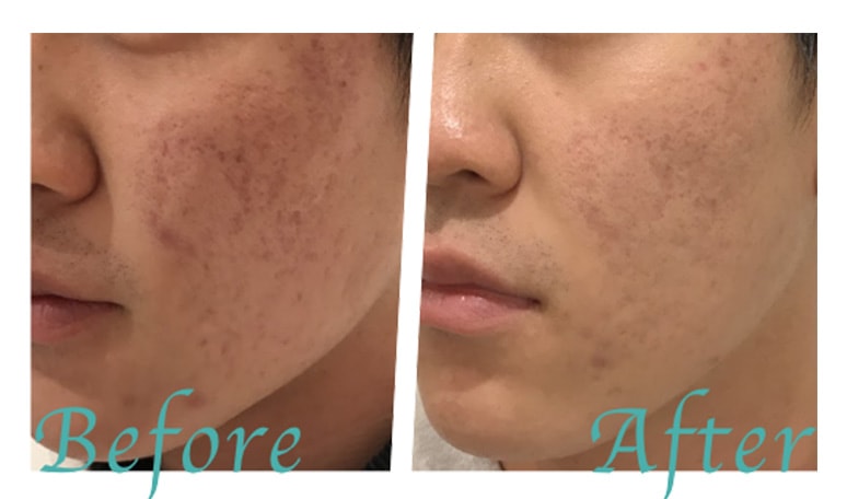 ビフォーアフター