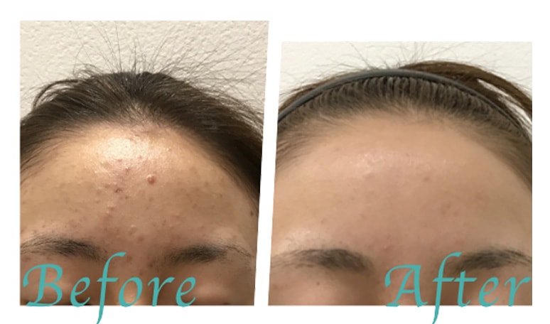 ビフォーアフター