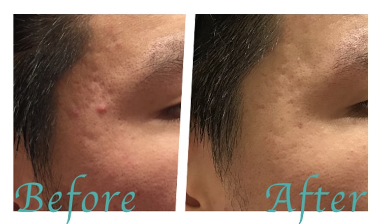 ビフォーアフター