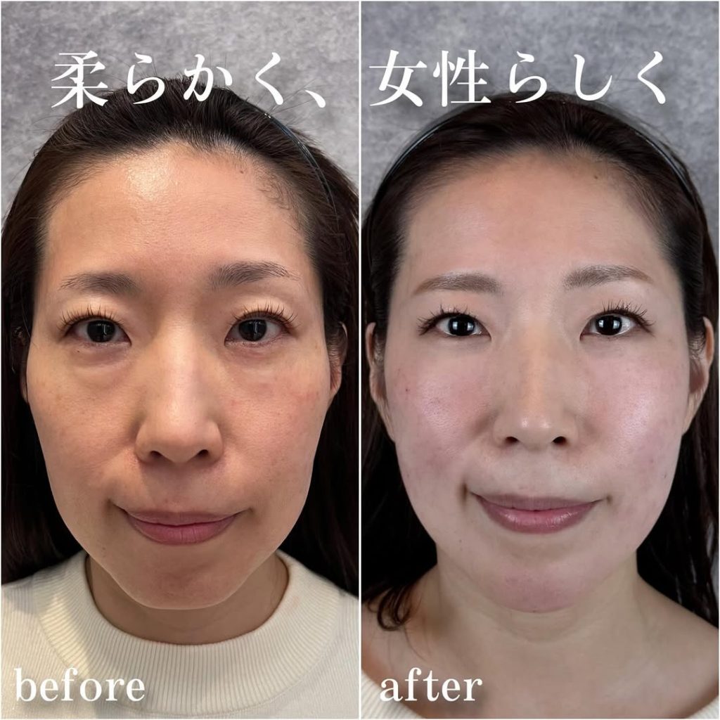 ビフォーアフター