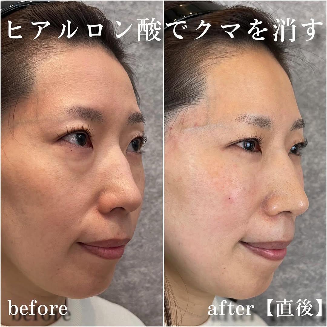 No.13535の症例写真