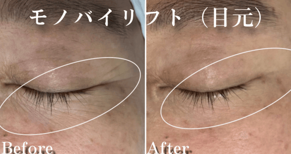 No.13677の症例写真