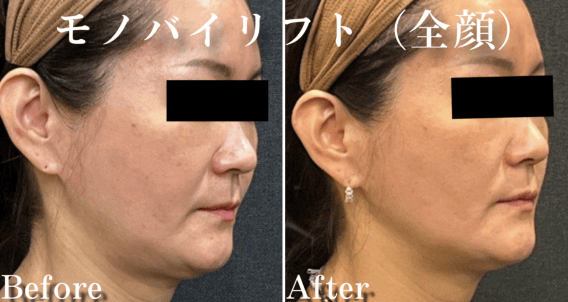 No.13676の症例写真