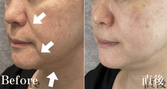 No.13675の症例写真