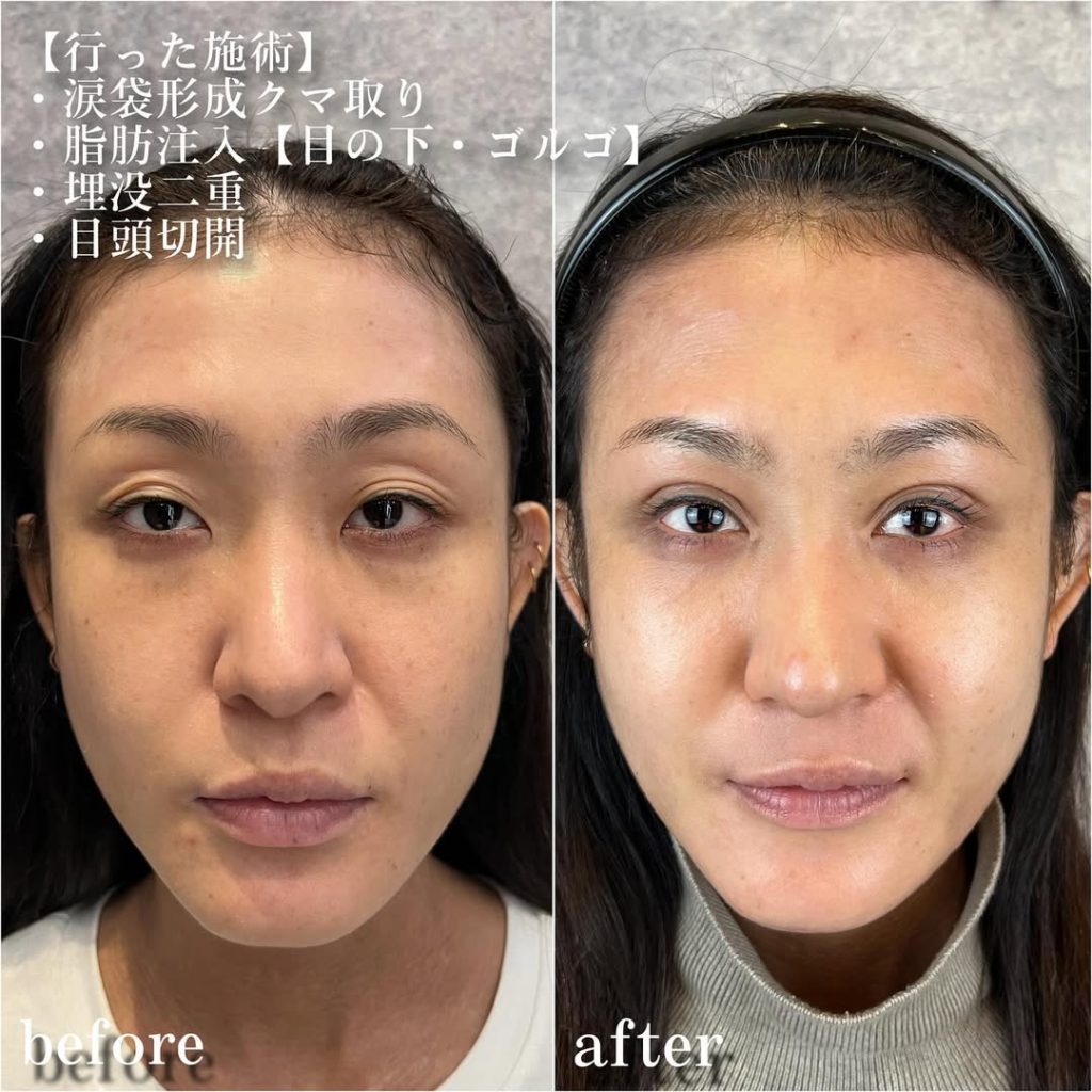 ビフォーアフター