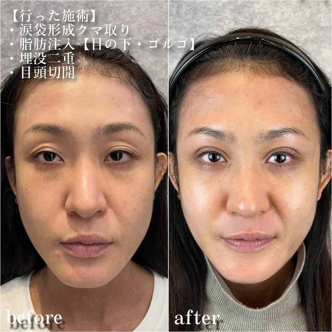 No.13544の症例写真