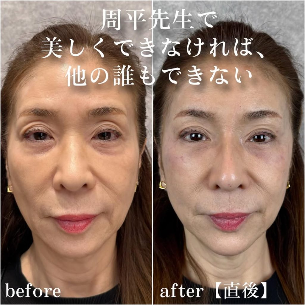 ビフォーアフター