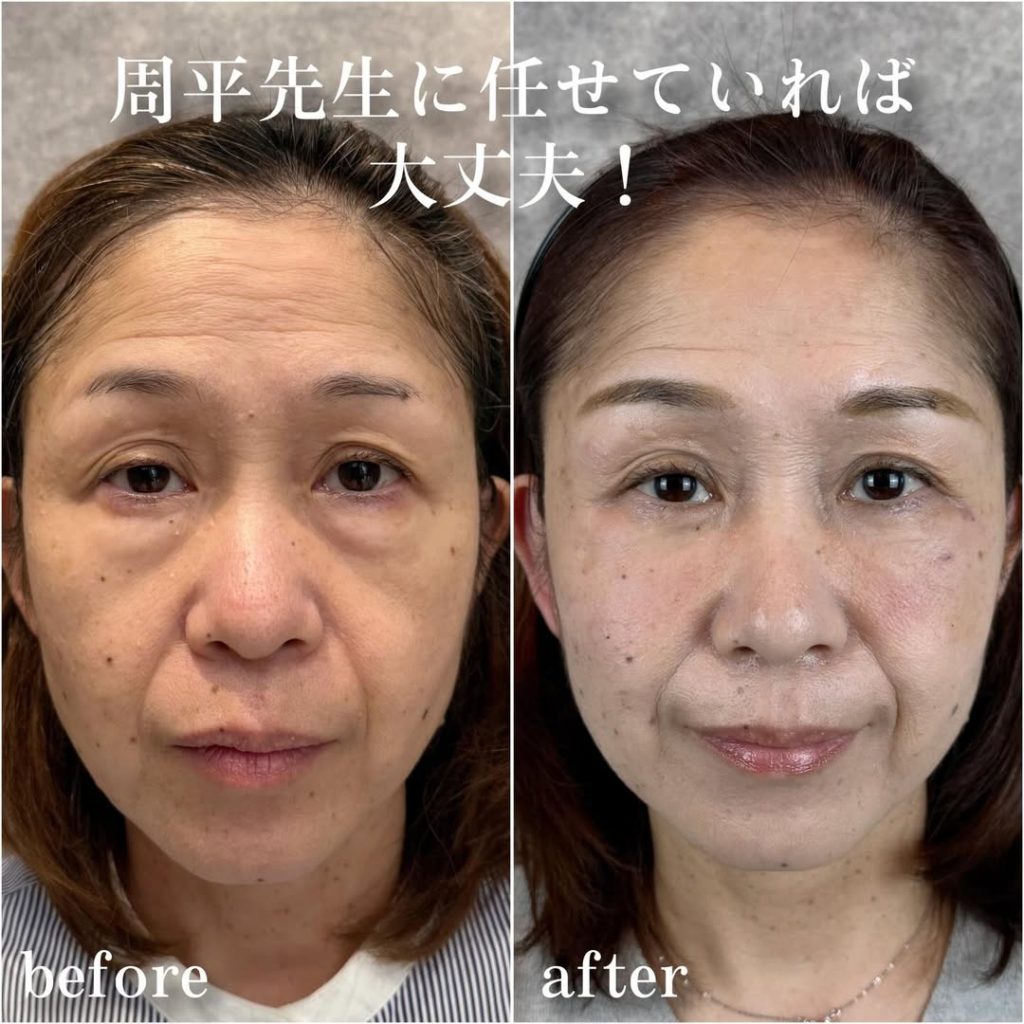 ビフォーアフター