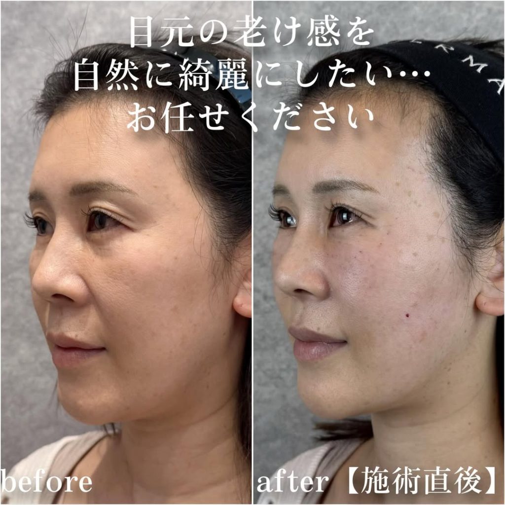 ビフォーアフター