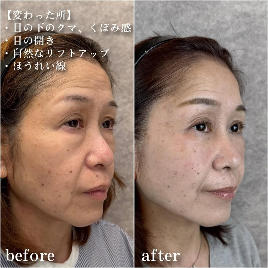 ビフォーアフター