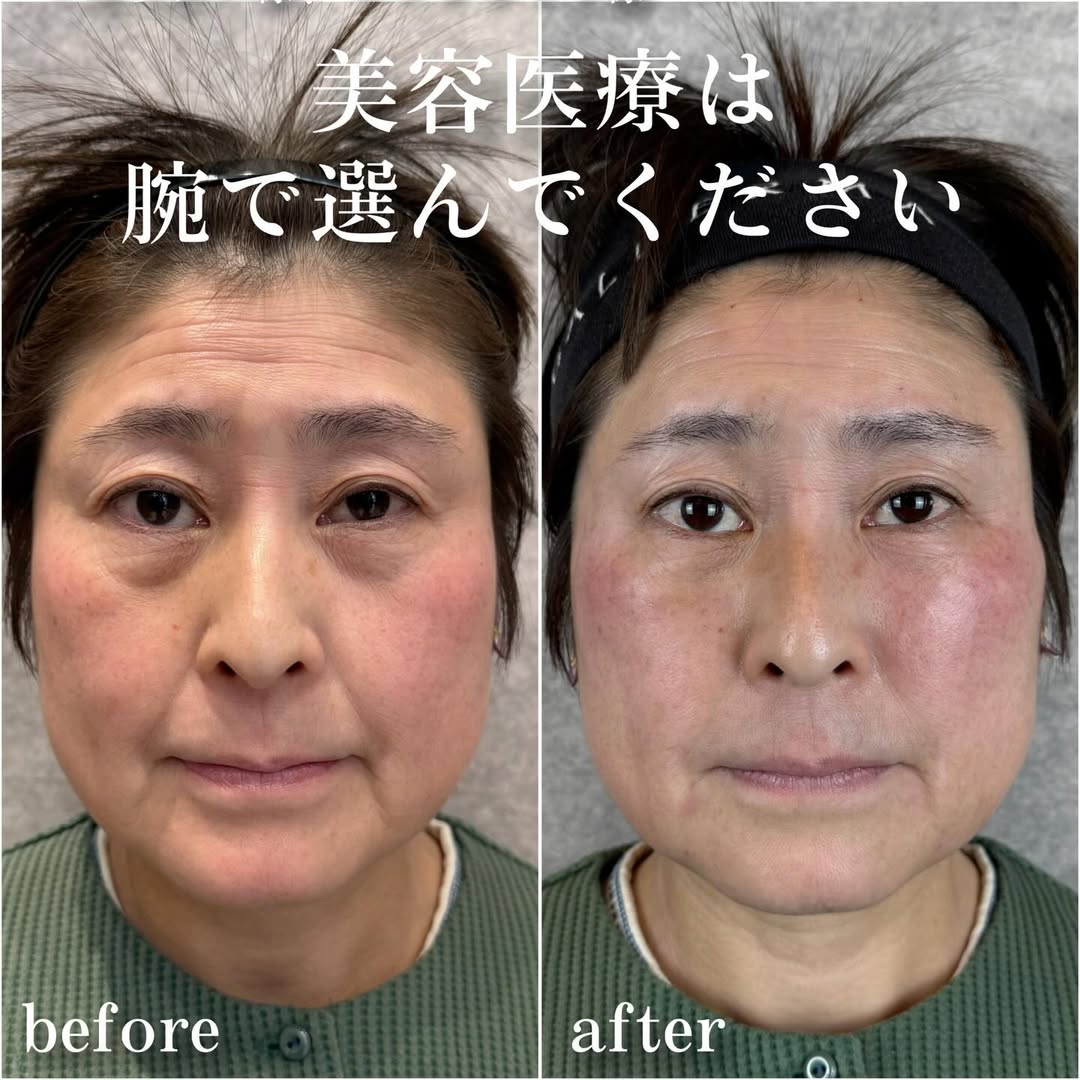 No.13740の症例写真