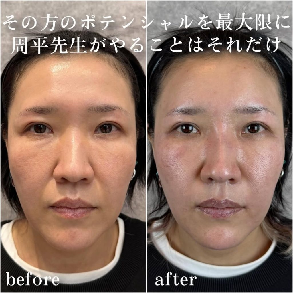 ビフォーアフター